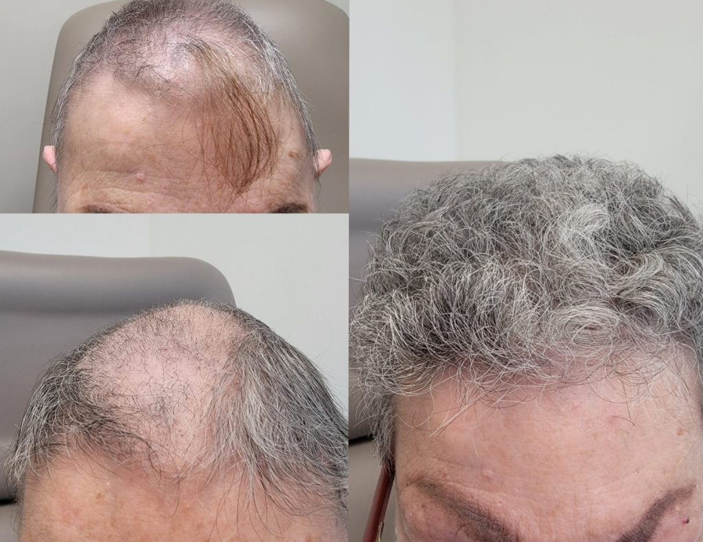 InCollage_20230420_134039045