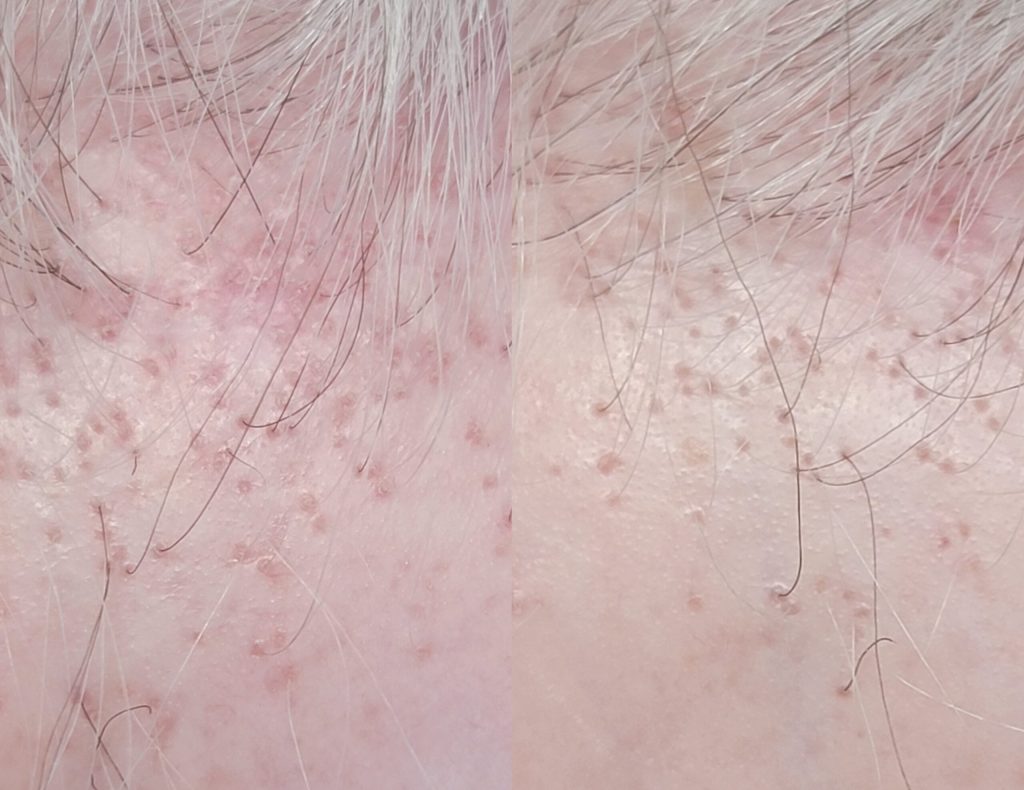 InCollage_20230524_102322238