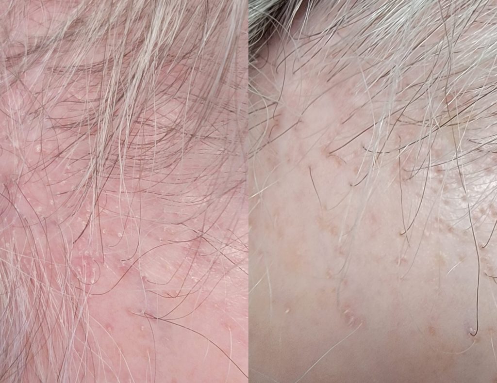 InCollage_20230524_112247347