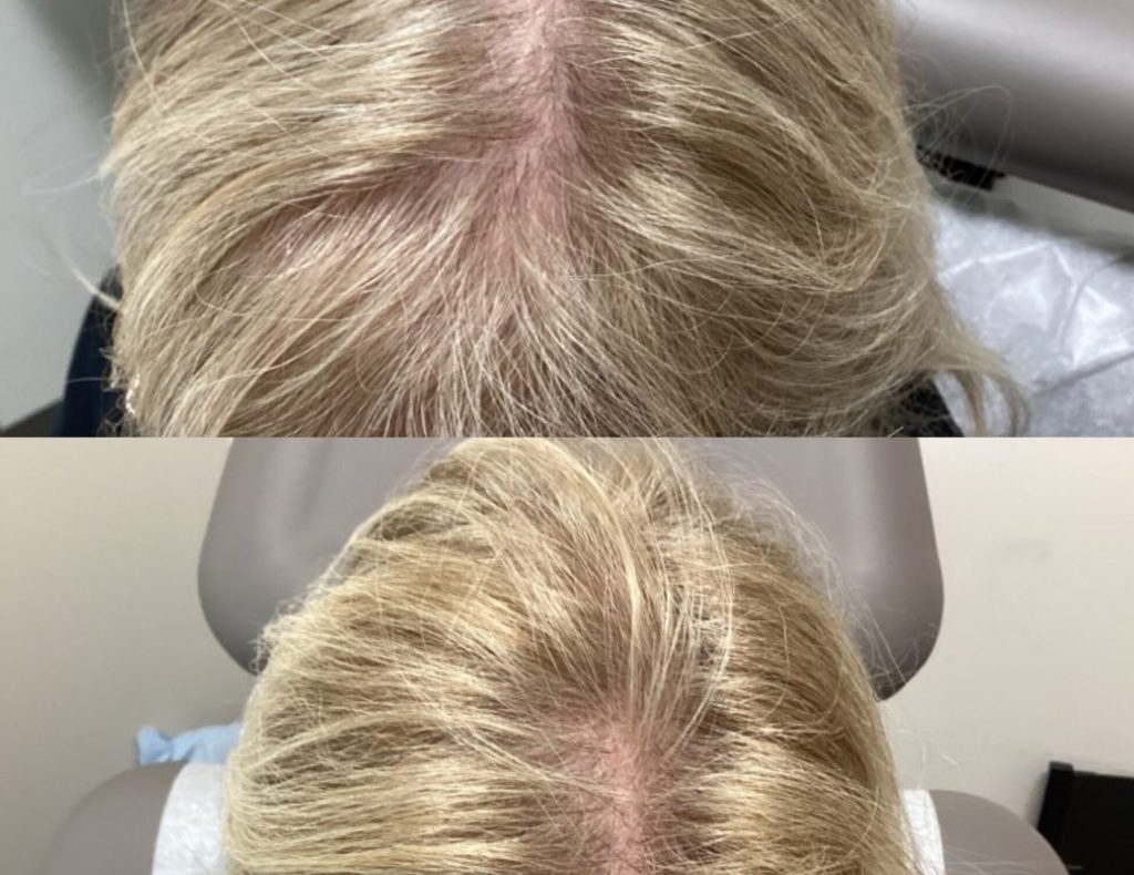 InCollage_20230808_160913188