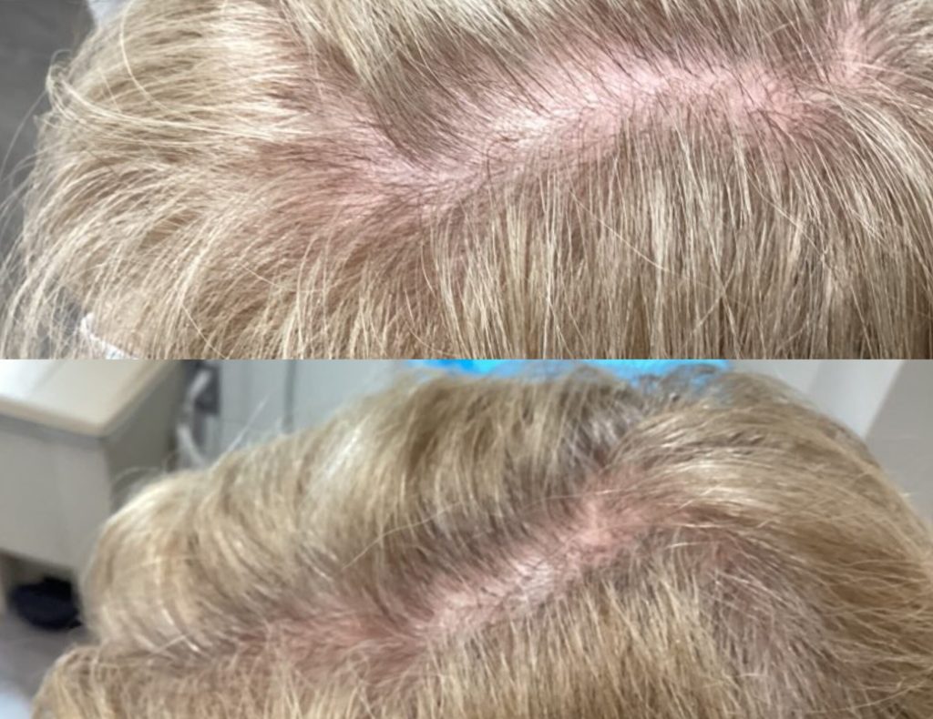 InCollage_20230808_161039471