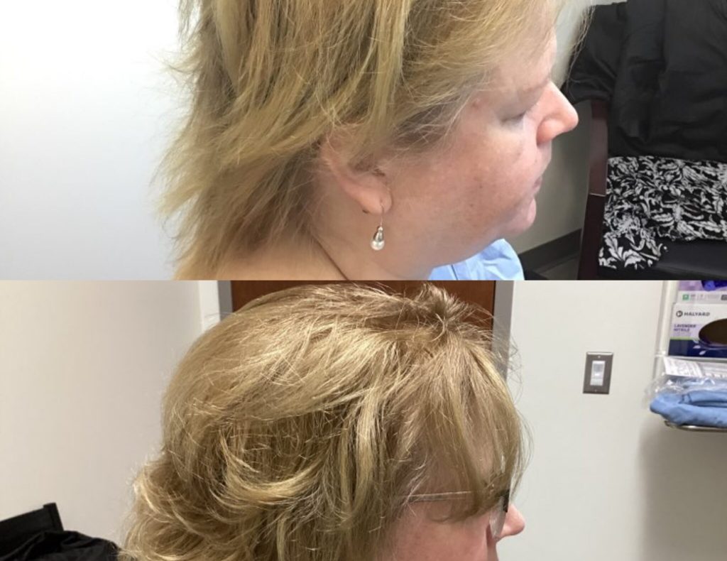 InCollage_20240214_084942264