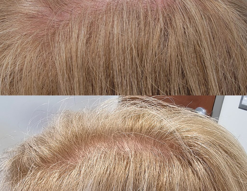 InCollage_20240214_165417919