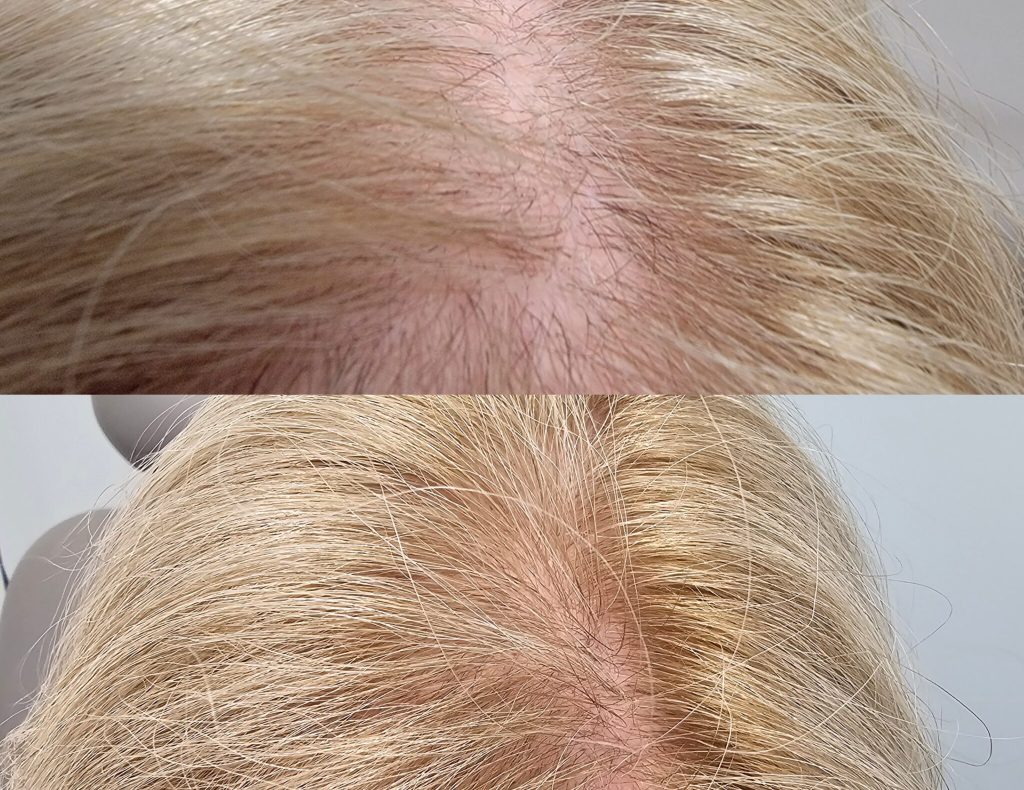 InCollage_20240214_165537962