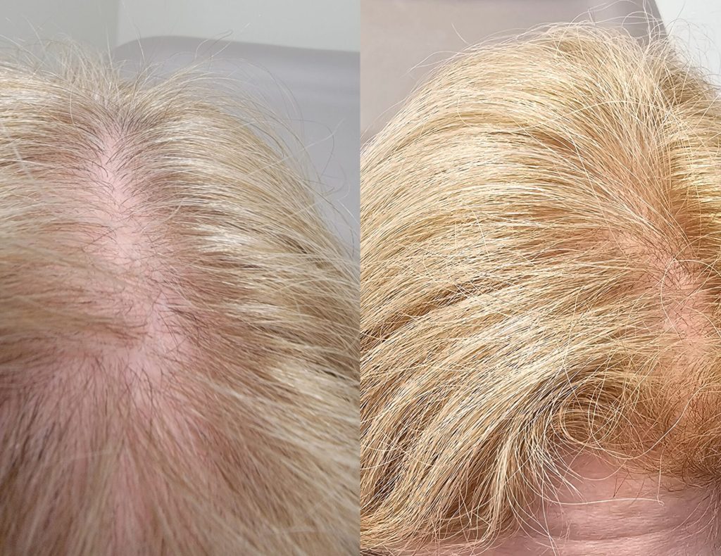 InCollage_20240214_165631235