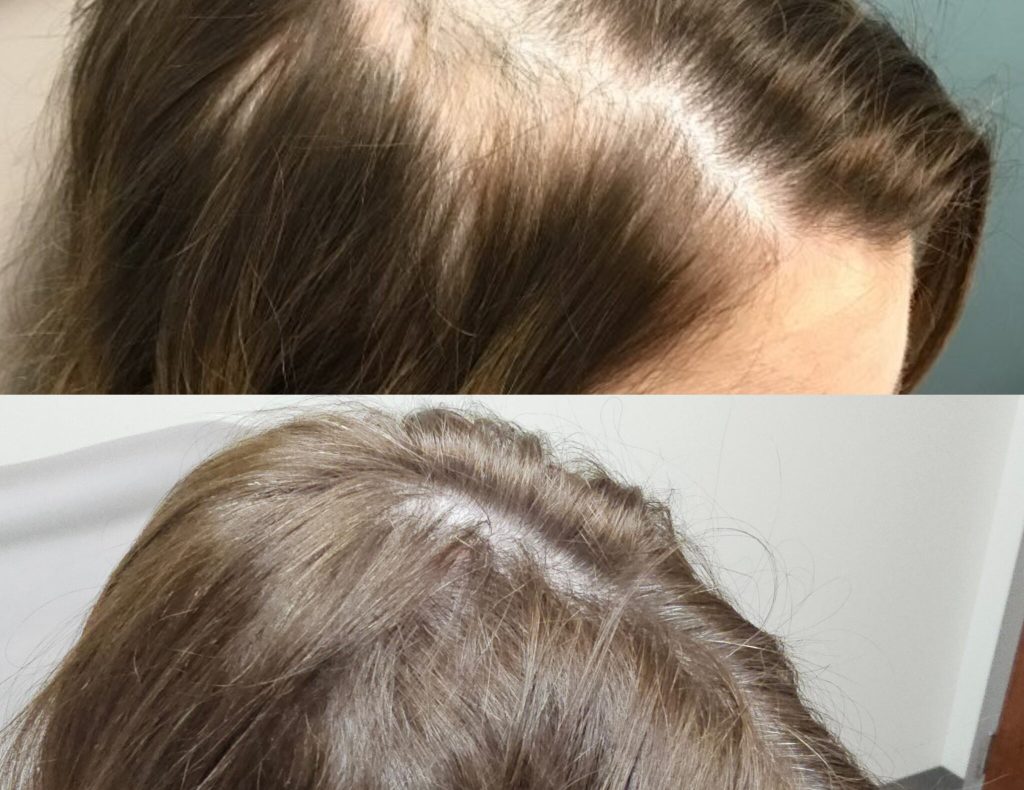 InCollage_20240219_160539097