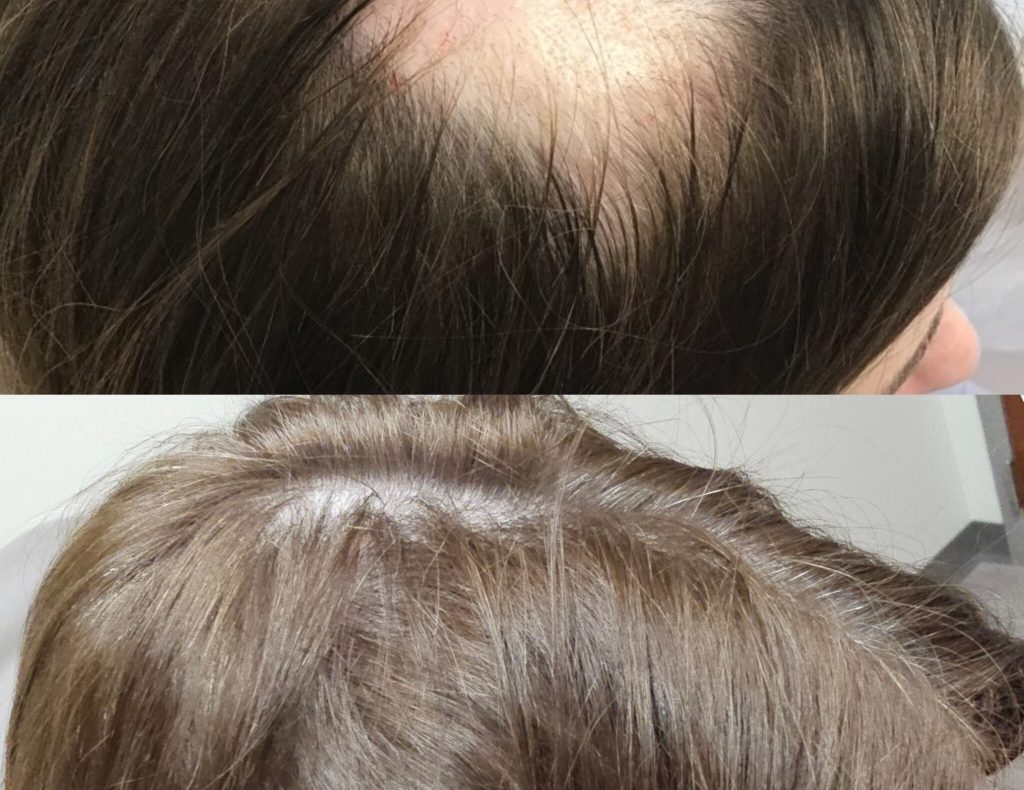 InCollage_20240219_160703672